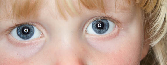 ringflash_feat